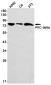 [KD]PKC delta Rabbit mAb ABZ4689