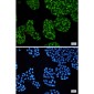 [KD]cAMP Protein Kinase Catalytic Subunit Rabbit mAb ABZ4690