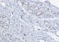 [KD]cAMP Protein Kinase Catalytic Subunit Rabbit mAb ABZ4690
