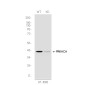 [KD]cAMP Protein Kinase Catalytic Subunit Rabbit mAb ABZ4690