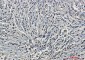 [KD]Phospho-PKC alpha (Ser657) Rabbit mAb ABZ4691