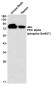 [KD]Phospho-PKC alpha (Ser657) Rabbit mAb ABZ4691