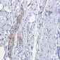[KO]Phospho-PKC alpha (Thr638) Rabbit mAb ABZ4692