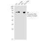 [KO]Phospho-PKC alpha (Thr638) Rabbit mAb ABZ4692