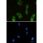 [KO]Aldolase Rabbit mAb ABZ4694