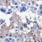 [KO]Catalase Rabbit mAb ABZ4695