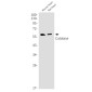 [KO]Catalase Rabbit mAb ABZ4695