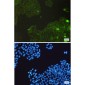 [KO]Catalase Rabbit mAb ABZ4696