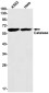 [KO]Catalase Rabbit mAb ABZ4696
