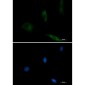[KO]EGFR Rabbit mAb ABZ4697