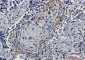 [KO]EGFR Rabbit mAb ABZ4697