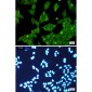 [KO]EGFR Rabbit mAb ABZ4698