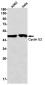 [KO]Cyclin E2 Rabbit mAb ABZ4699