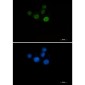 [KO]Chk2 Rabbit mAb ABZ4700