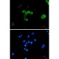 [KO]CRABP2 Rabbit mAb ABZ4704