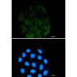 [KO]Integrin alpha V Rabbit mAb ABZ4705