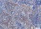 [KO]Integrin alpha V Rabbit mAb ABZ4706