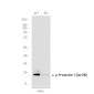 [KD]Phospho-Presenilin 1 (Ser310) Rabbit mAb ABZ4707