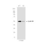 [KD]Cyclin B1 Rabbit mAb ABZ4708
