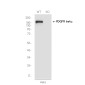 [KO]PDGFR beta Rabbit mAb ABZ4709
