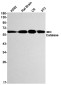 [KO]Catalase Rabbit mAb ABZ4711