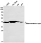 [KD]Creatine Kinase B type Rabbit mAb ABZ4713
