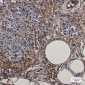 [KD]Creatine Kinase B type Rabbit mAb ABZ4714