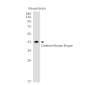 [KD]Creatine Kinase B type Rabbit mAb ABZ4714