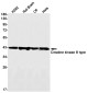 [KD]Creatine Kinase B type Rabbit mAb ABZ4714
