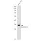 [KD]DARPP32 Rabbit mAb ABZ4716