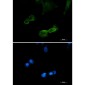 [KD]DCAMKL1 Rabbit mAb ABZ4717