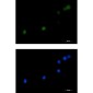 [KD]DKC1 Rabbit mAb ABZ4718