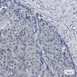 [KD]DKC1 Rabbit mAb ABZ4718