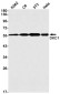 [KD]DKC1 Rabbit mAb ABZ4718