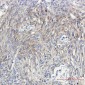 [KD]Phospho-PKC gamma (Thr514) Rabbit mAb ABZ4723