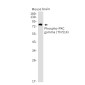 [KD]Phospho-PKC gamma (Thr514) Rabbit mAb ABZ4723