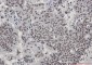 [KO]Phospho-HSF1 (Ser303/Ser307) Rabbit mAb ABZ4731