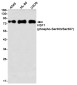 [KO]Phospho-HSF1 (Ser303/Ser307) Rabbit mAb ABZ4731