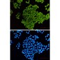 [KO]Cofilin 1 Rabbit mAb ABZ4736