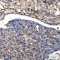 [KO]Cofilin 1 Rabbit mAb ABZ4736