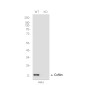 [KO]Cofilin 1 Rabbit mAb ABZ4736