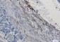 [KO]Integrin alpha 5 Rabbit mAb ABZ4742