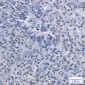 [KO]PRMT1 Rabbit mAb ABZ4745