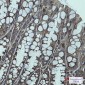 IGF2BP1 Rabbit mAb ABZ4749