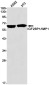 IGF2BP1 Rabbit mAb ABZ4749