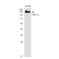 [KD]KDM2A Rabbit mAb ABZ4758