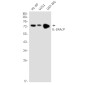 [KO]IL-1RAcP Rabbit mAb ABZ4760