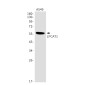 [KO]LPCAT1 Rabbit mAb ABZ4762