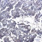 [KD]TORC2 Rabbit mAb ABZ4763