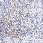 [KO]DAB2 Rabbit mAb ABZ4766